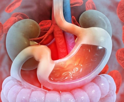 Bạn có nguy cơ cao mắc xuất huyết tiêu hóa không?